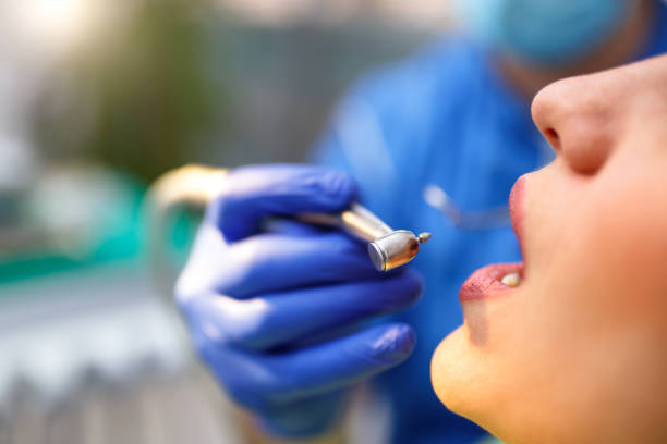 Best Wisdom Tooth Removal  in Gretna, LA